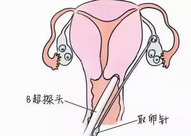 我取了多少卵？为什么别人取的卵都比我多？
