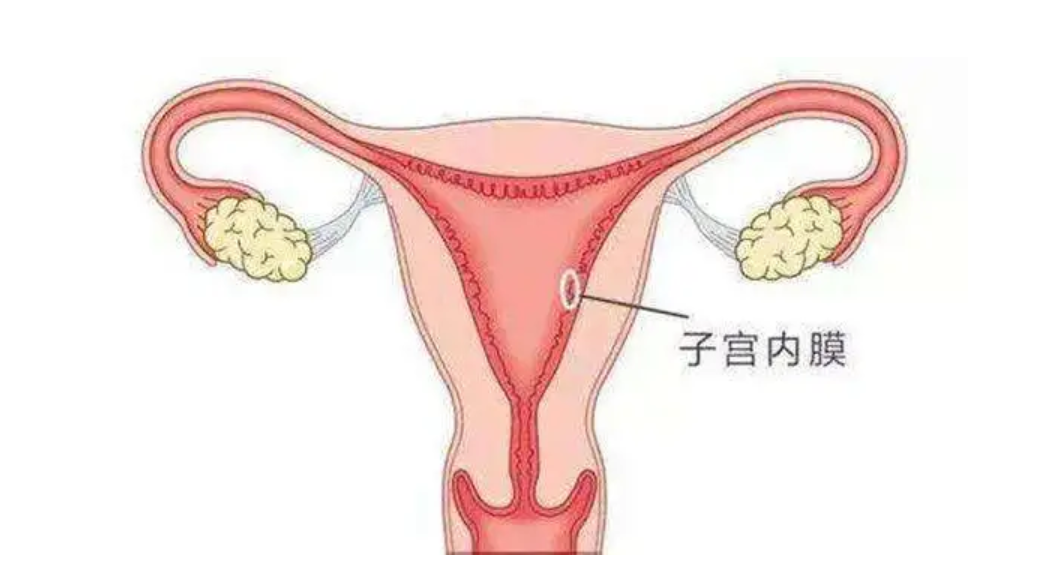 什么是子宫内膜