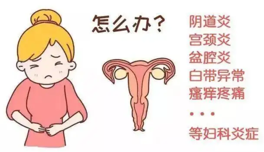 什么是妇科炎症