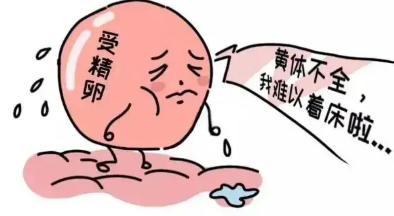 什么是黄体功能不全性不孕