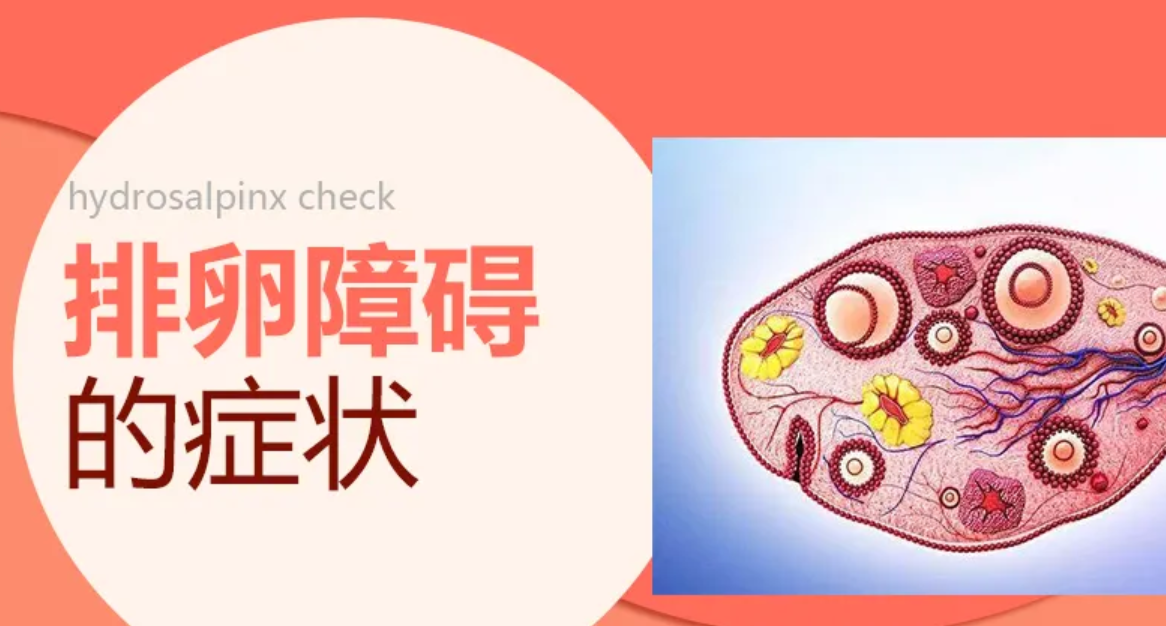 什么是无排卵性不孕症