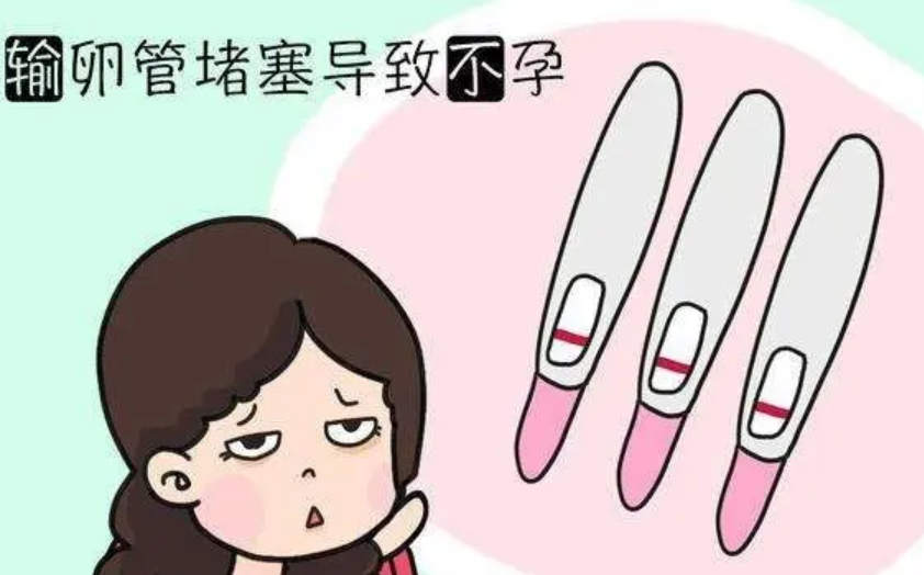 输卵管性不孕怎么办