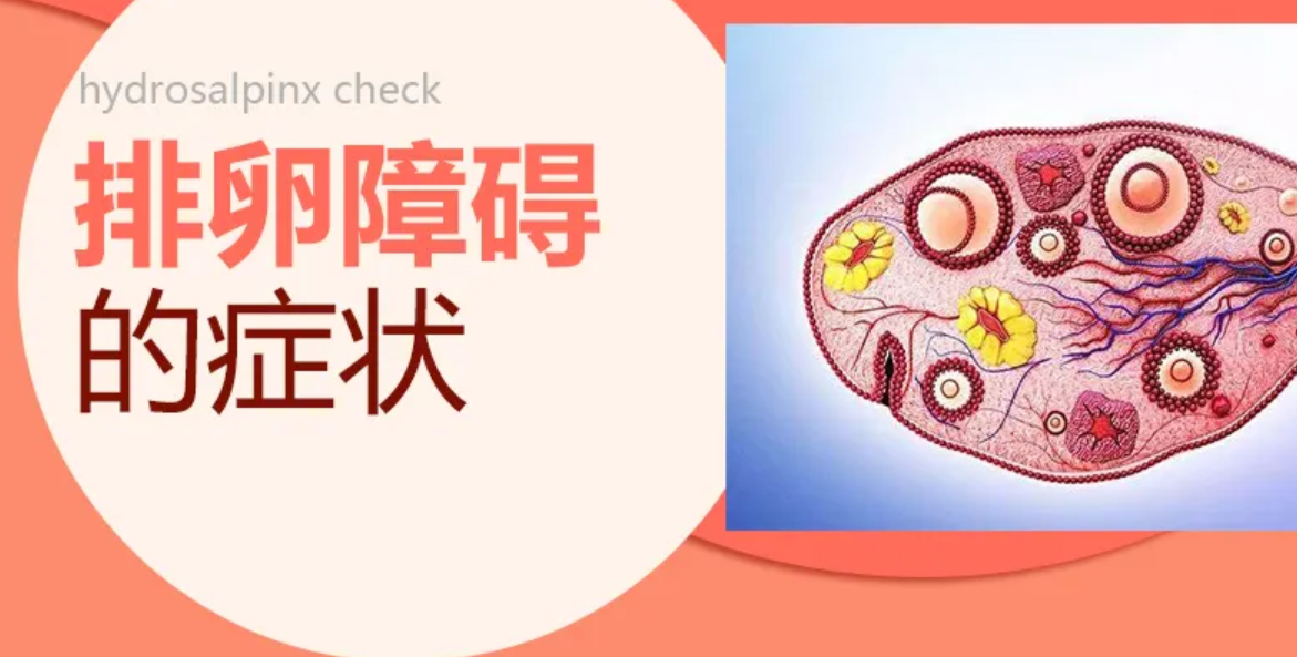 排卵障碍的症状