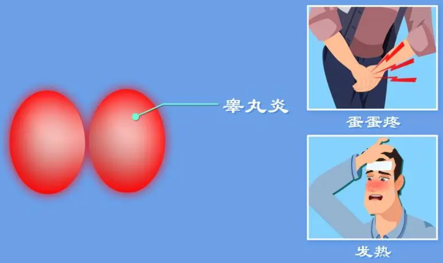 什么是睾丸炎
