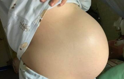 胎儿发育受什么影响？营养科不背锅