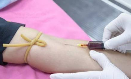 甲状腺检查没必要？别让它阻止你当妈妈