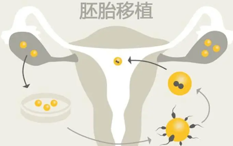 试管移植失败和胖有关系吗