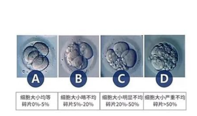试管婴儿胚胎怎么评级？胚胎级别和怀孕有关系？