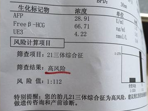 唐筛看风险值结果还是看三项mom值更准确？