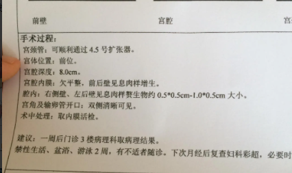 宫腔镜手术前期准备工作有哪些  插管是提前一天插吗