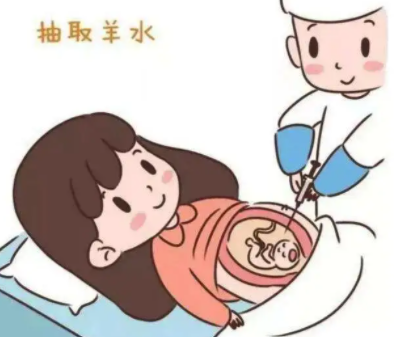 三代试管高龄需要做羊穿吗？