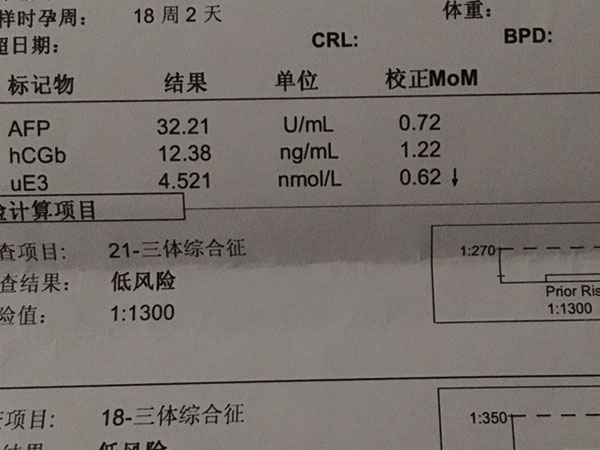 唐筛结果临界风险都是男宝宝的说法是真的吗？