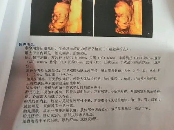 三维照片一看两腿中间有圆圆的凸起就是男孩吗？