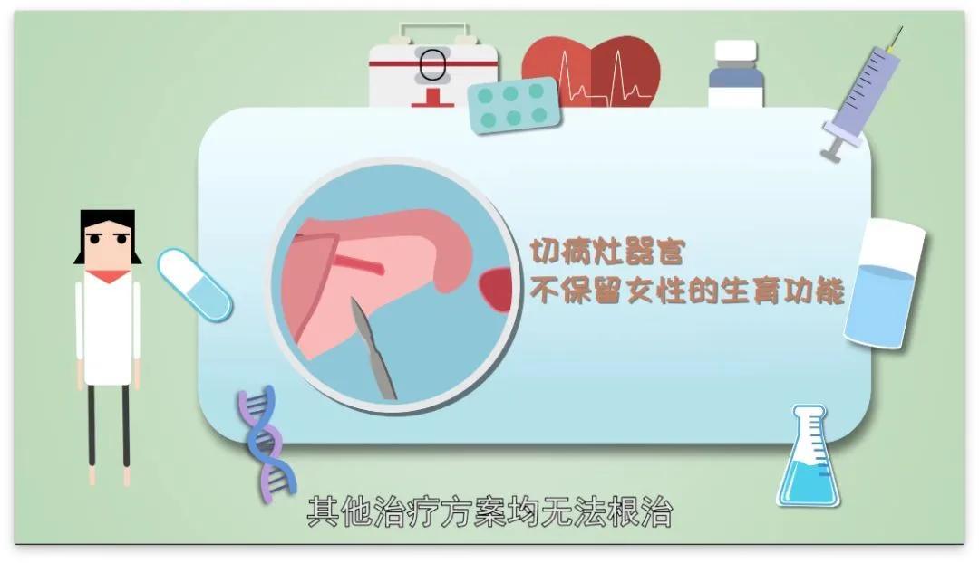 “不死的癌症”——子宫内膜异位症详解