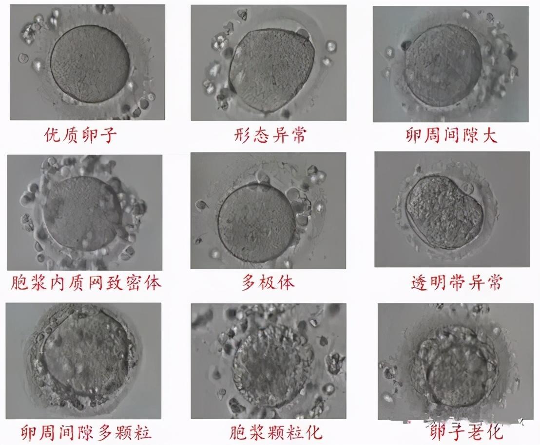 胚胎质量差,谁之过,卵子or精子?