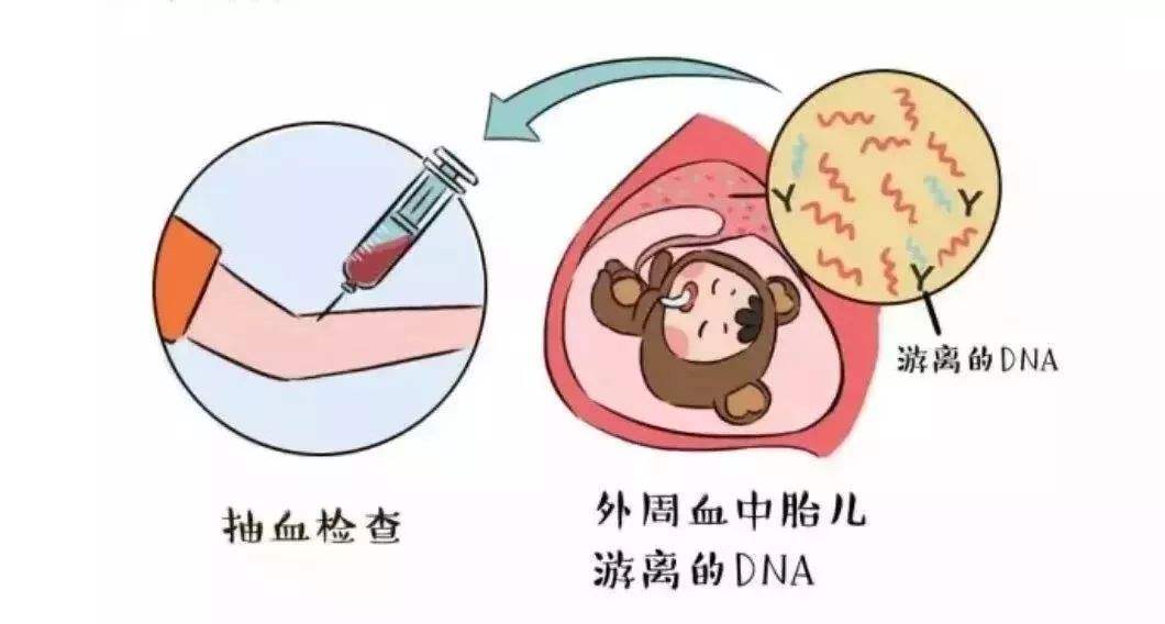 这三类孕妇容易怀上“唐氏儿”!如何预防唐氏综合征是关键