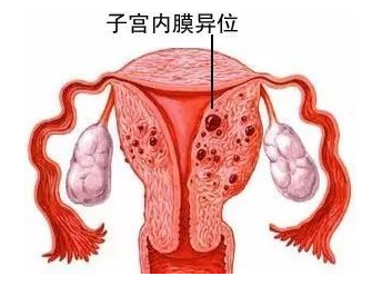 女性不孕或是这9个原因导致,身体这几个信号提示要格外注意