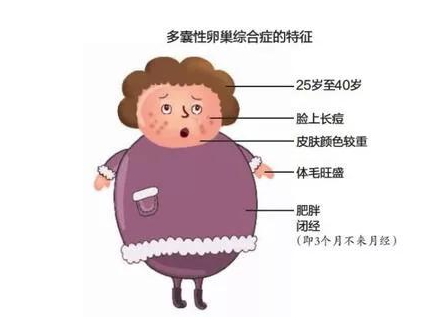 女性不孕或是这9个原因导致,身体这几个信号提示要格外注意