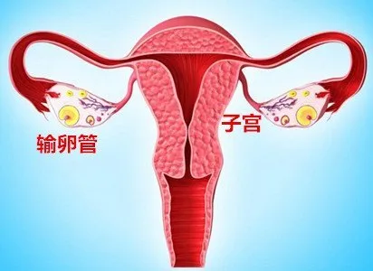 注意!输卵管不通就代表生子路不通