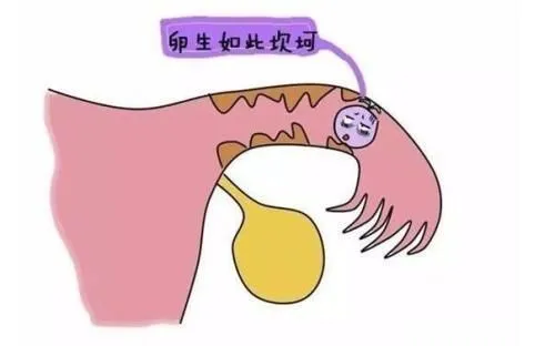 注意!输卵管不通就代表生子路不通