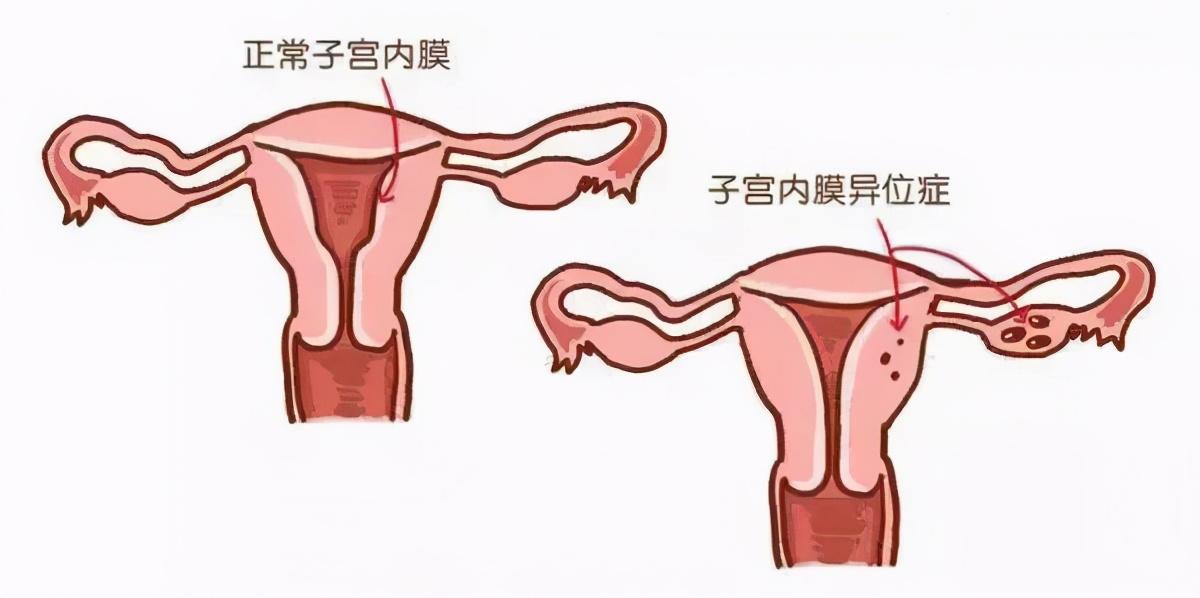 试管婴儿移植失败后,怎样治疗才能提高成功率?
