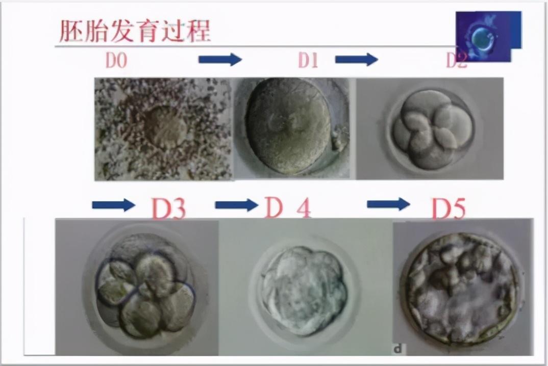 如何计算试管婴儿的预产期?