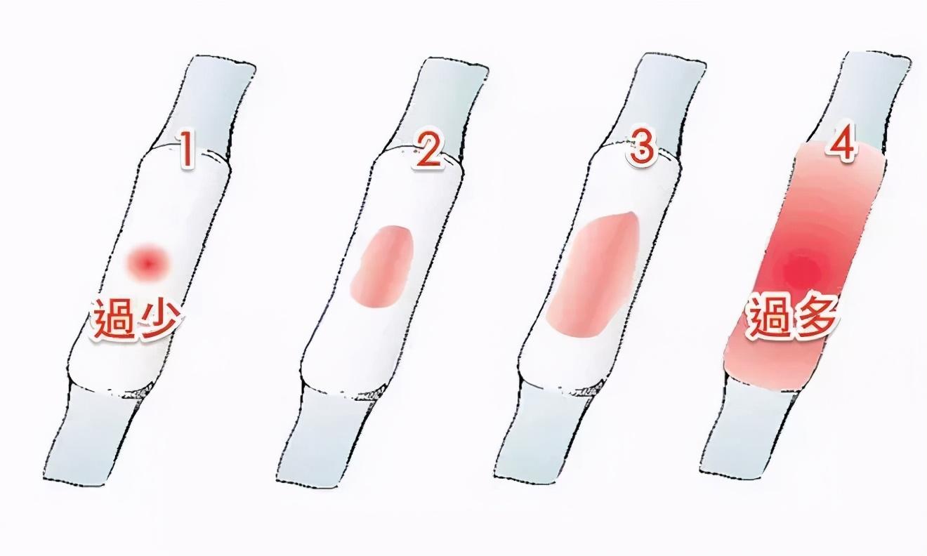 月经量变少,是我卵巢早衰了吗?影响生育吗?