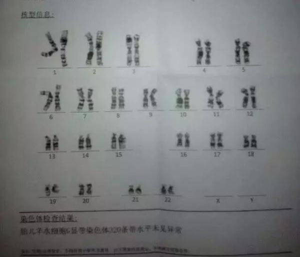辟谣|怀孕50天,超声看孕囊能看出男女?