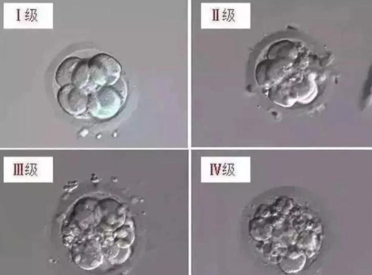 胚胎等级划分标准