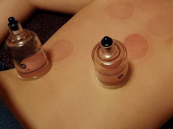 孕前期间刮痧拔罐排毒真的可以帮助怀孕吗？